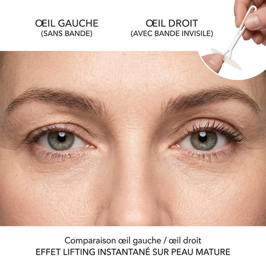 Bandes correctrices pour paupières Lumonix™